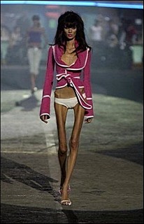 Anorektyczna modelka